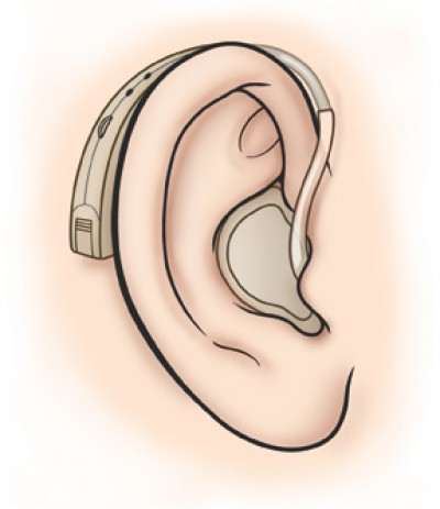 JJC Kruger & Partners Hearing Center