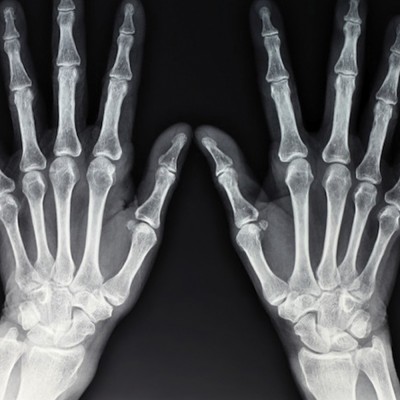 X-Ray Studio